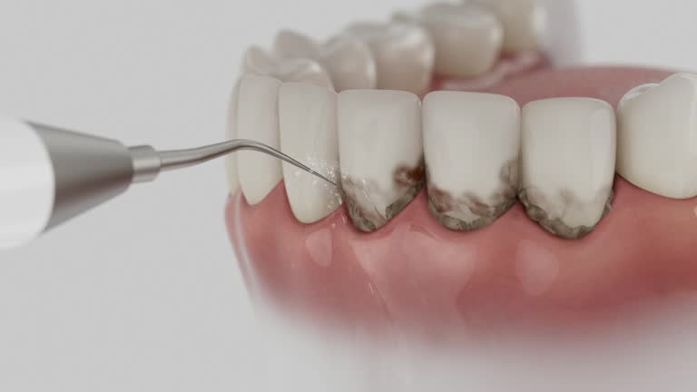 Trusted Emergency Dentist service in Fort Lauderdale, FL - Dentist Open Now